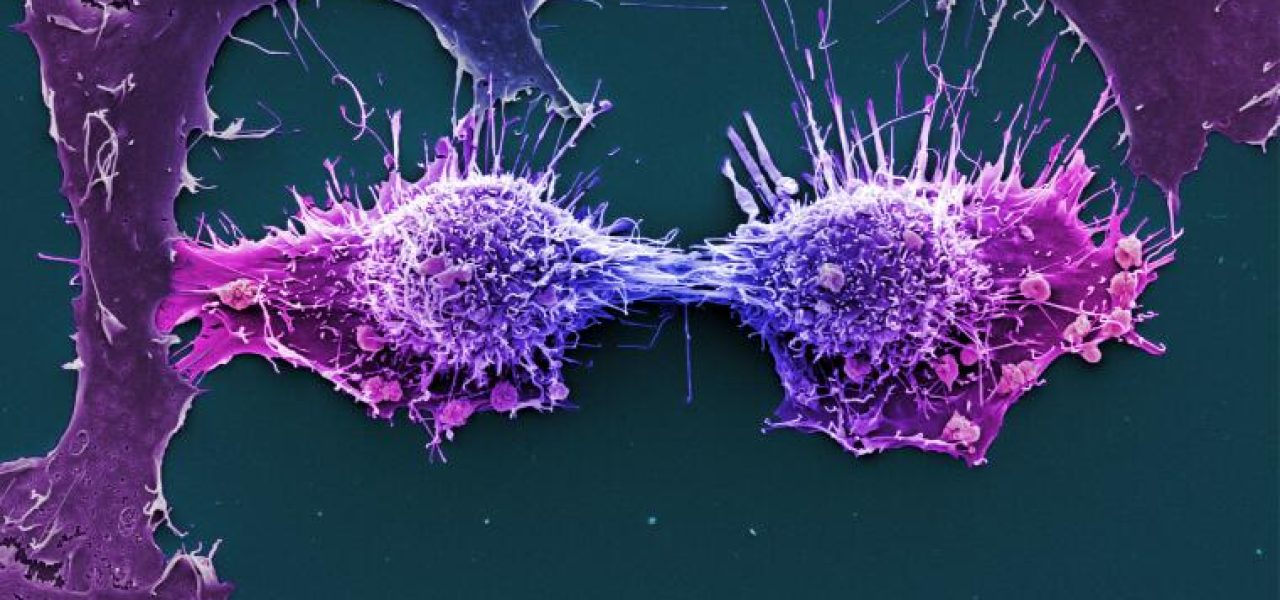 células de cáncer de cuello uterino dividiéndose