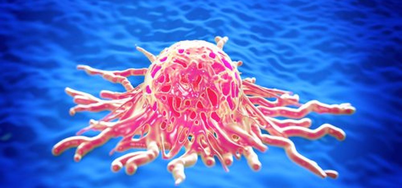 celula . cancer de cervix